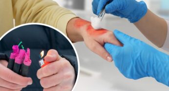 Botti di Capodanno, cosa fare in caso di ustioni e bruciature